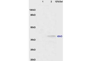 Lane 1: mouse lung lysates Lane 2: mouse brain lysates probed with Anti CNR2/CB2 Polyclonal Antibody, Unconjugated (ABIN680168) at 1:200 in 4 °C. (CNR2 antibody  (AA 251-350))