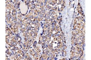 IHC analysis of MRPS25 using anti-MRPS25 antibody (ABIN7599032).