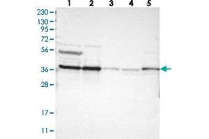 Western blot analysis of Lane 1: RT-4, Lane 2: U-251 MG, Lane 3: Human Plasma, Lane 4: Liver, Lane 5: Tonsil with CALHM2 polyclonal antibody . (CALHM2 antibody)