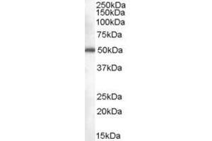 Western Blotting (WB) image for anti-CDK5 Regulatory Subunit Associated Protein 3 (CDK5RAP3) (C-Term) antibody (ABIN2156583) (CDK5RAP3 antibody  (C-Term))