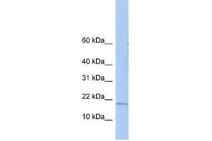 ZNHIT3 antibody used at 0. (ZNHIT3 antibody  (N-Term))