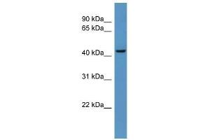 Western Blotting (WB) image for anti-UDP-Gal:betaGlcNAc beta 1,4-Galactosyltransferase, Polypeptide 6 (B4GALT6) (C-Term) antibody (ABIN928112)