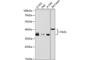 Western blot analysis of extracts of various cell lines, using P antibody (ABIN6133850, ABIN6145258, ABIN6145259 and ABIN6215616) at 1:1000 dilution. (PAX5 antibody  (AA 1-100))