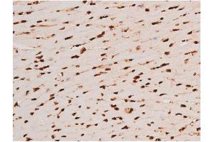 Immunohistochemistry (IHC) image for anti-REL proto-oncogene (c-Rel) (pSer503) antibody (ABIN6255382)