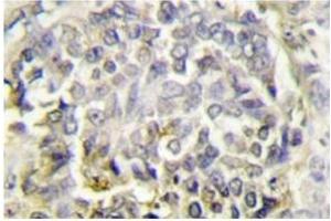 Image no. 1 for anti-PYD and CARD Domain Containing (PYCARD) antibody (ABIN272291) (PYCARD antibody)