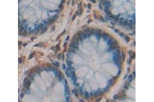 Figure. (MTAP antibody  (AA 11-256))