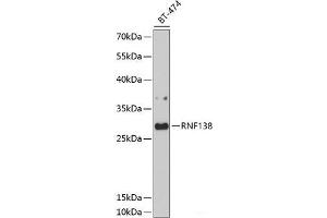 Western blot analysis of extracts of BT-474 cells using RNF138 Polyclonal Antibody at dilution of 1:1000. (RNF138 antibody)