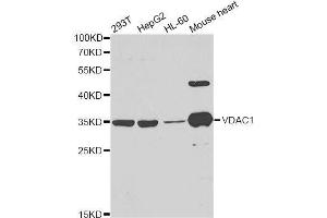 Western blot analysis of extracts of various cell lines, using VDAC1 antibody.
