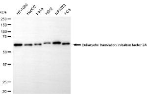 Western blotting analysis using eukaryotic translation initiation factor 2A antibody (ABIN7798513).