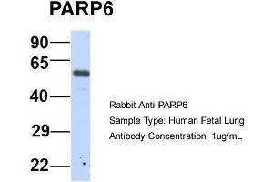 Host:  Rabbit  Target Name:  P Sample Type:  Human Fetal Lung  Antibody Dilution:  1. (PARP6 antibody  (N-Term))