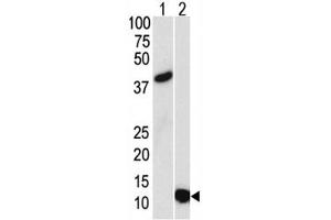 Western blot analysis of SUMO3 antibody and (1) GST-SUMO3 recombinant protein and (2) HL-60 lysate. (SUMO3 antibody)