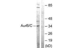 Western Blotting (WB) image for anti-Aurora Kinase B/C (AURKB/C) (Thr175), (Thr202) antibody (ABIN1848068) (AurB/C antibody  (Thr175, Thr202))