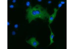 Anti-KLHL2 mouse monoclonal antibody (ABIN2453208) immunofluorescent staining of COS7 cells transiently transfected by pCMV6-ENTRY KLHL2 (RC205347). (KLHL2 antibody  (AA 1-100, AA 494-593))
