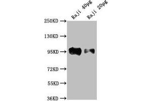 Western Blot Positive WB detected in: Raji whole cell lysate All lanes: CD19 antibody at 1:2000 Secondary Goat polyclonal to Mouse IgG at 1/10000 dilution Predicted band size: 61 kDa Observed band size: 95 kDa (CD19 antibody  (AA 20-291))