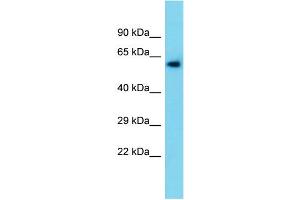 Host:  Rabbit  Target Name:  Tymp  Sample Type:  Rat Liver lysates  Antibody Dilution:  1. (Thymidine Phosphorylase antibody  (N-Term))