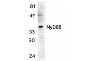 Western Blotting (WB) image for anti-Myeloid Differentiation Primary Response Gene (88) (MYD88) (C-Term) antibody (ABIN1030526) (MYD88 antibody  (C-Term))