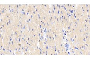 Detection of ACVR1 in Human Cardiac Muscle Tissue using Polyclonal Antibody to Activin A Receptor Type I (ACVR1) (ACVR1 antibody  (AA 208-340))