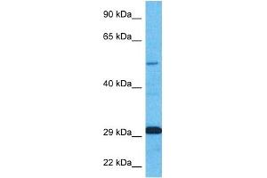 Host:  Rabbit  Target Name:  ZNF35  Sample Type:  Fetal Kidney lysates  Antibody Dilution:  1. (ZNF35 antibody  (N-Term))