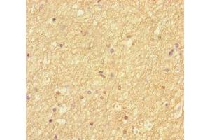 Immunohistochemistry of paraffin-embedded human brain tissue using ABIN7168865 at dilution of 1:100 (Septin 2 antibody  (AA 1-361))