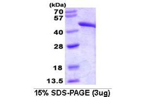 SDS-PAGE (SDS) image for Fumarate Hydratase (FH) (AA 44-510) protein (ABIN666730)