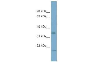 IGFBP2 antibody used at 1 ug/ml to detect target protein. (IGFBP2 antibody  (Middle Region))