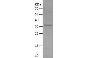 CCDC25 Protein (AA 1-140) (His-IF2DI Tag)