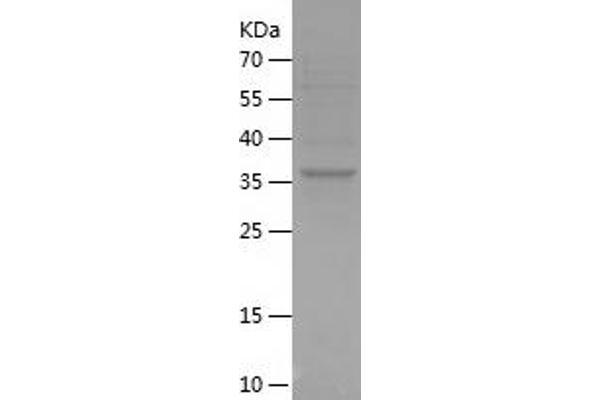 CCDC25 Protein (AA 1-140) (His-IF2DI Tag)