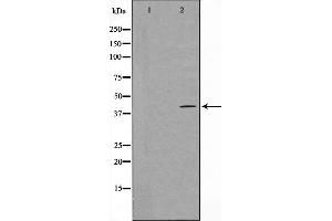Western blot analysis on HeLa cell lysate using 5-HT-5A Antibody,The lane on the left is treated with the antigen-specific peptide. (Serotonin Receptor 5A antibody  (Internal Region))