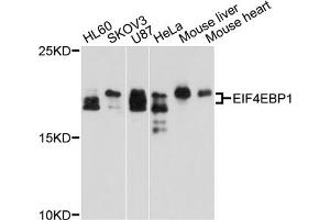 Western blot analysis of extracts of various cell lines, using EIF4EBP1 antibody (ABIN5970590) at 1/1000 dilution. (eIF4EBP1 antibody)