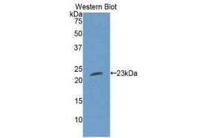 Western Blotting (WB) image for anti-Cardiotrophin 1 (CTF1) (AA 1-201) antibody (ABIN1077903) (Cardiotrophin 1 antibody  (AA 1-201))