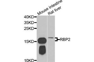 Western blot analysis of extracts of mouse intestine and rat liver cells, using RBP2 antibody. (RBP2 antibody)