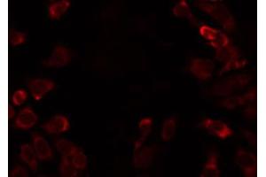 ABIN6274798 staining HT29 by IF/ICC. (ACSS1 antibody  (C-Term))