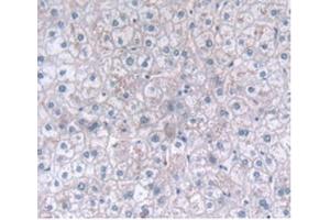 Detection of CLEC4C in Human Liver Tissue using Polyclonal Antibody to C-Type Lectin Domain Family 4, Member C (CLEC4C) (CLEC4C antibody  (AA 5-152))