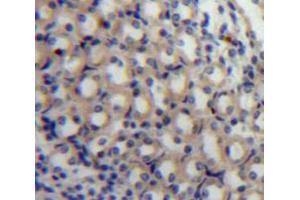 Used in DAB staining on fromalin fixed paraffin-embedded Kidney tissue (MAP4 antibody  (AA 882-1062))