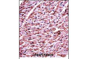 DHRS7C Antibody (Center) ((ABIN657710 and ABIN2846701))immunohistochemistry analysis in formalin fixed and paraffin embedded human heart tissue followed by peroxidase conjugation of the secondary antibody and DAB staining. (DHRS7C antibody  (AA 116-145))