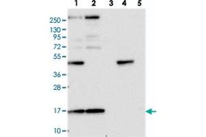 Western blot analysis of Lane 1: RT-4, Lane 2: U-251 MG, Lane 3: Human Plasma, Lane 4: Liver, Lane 5: Tonsil with RPS19BP1 polyclonal antibody  at 1:250-1:500 dilution. (RPS19BP1 antibody)