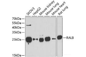 Western blot analysis of extracts of various cell lines using RALB Polyclonal Antibody at dilution of 1:1000. (RALB antibody)
