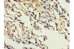 Immunohistochemistry of paraffin-embedded human lung tissue using ABIN7150057 at dilution of 1:100 (ADAM33 antibody  (AA 140-420))
