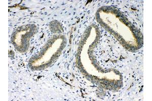 IHC analysis of PPID using anti-PPID antibody . (PPID antibody  (AA 306-370))