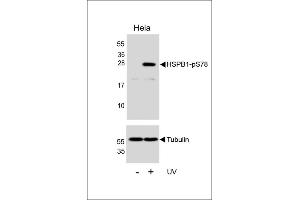Western blot analysis of lysates from Hela cell line, untreated or treated with UV, 2 hours, using HSPB1 Antibody (R)(upper) or Tubulin (lower). (HSP27 antibody  (pSer78))