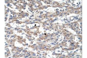 DUT antibody was used for immunohistochemistry at a concentration of 4-8 ug/ml. (Deoxyuridine Triphosphatase (DUT) (C-Term) antibody)