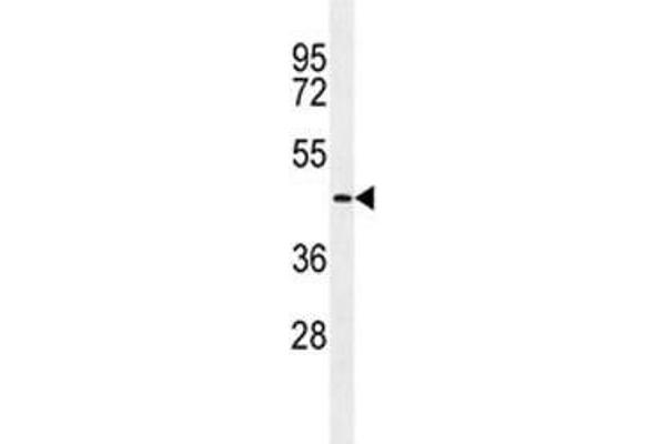 TMPRSS11E antibody  (AA 249-277)