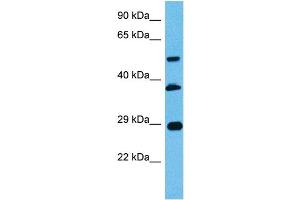 Host:  Mouse  Target Name:  PBX2  Sample Tissue:  Mouse Pancreas  Antibody Dilution:  1ug/ml (PBX2 antibody  (N-Term))