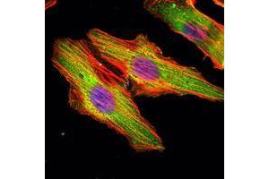 Immunofluorescence analysis of Hela cells using MATN1 mouse mAb (green). (MATN1 antibody)