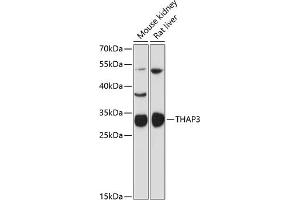 Western blot analysis of extracts of various cell lines, using TH antibody (ABIN6132722, ABIN6149110, ABIN6149112 and ABIN6216701) at 1:3000 dilution. (THAP3 antibody  (AA 1-239))