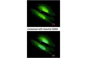 ICC/IF Image Immunofluorescence analysis of methanol-fixed HeLa, using PDE6D, antibody at 1:500 dilution. (PDE6D antibody  (full length))