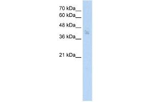 WB Suggested Anti-SPDEF Antibody Titration: 2. (SPDEF/PSE antibody  (N-Term))