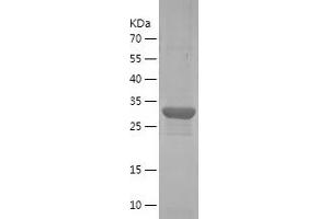 Western Blotting (WB) image for Villin 1 (VIL1) (AA 348-632) protein (His tag) (ABIN7283578) (Villin 1 Protein (VIL1) (AA 348-632) (His tag))