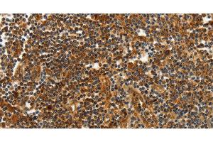 Immunohistochemistry of paraffin-embedded Human tonsil tissue using CNNM3 Polyclonal Antibody at dilution 1:40 (Cyclin M3 antibody)