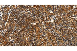 Immunohistochemistry of paraffin-embedded Human tonsil tissue using CNNM3 Polyclonal Antibody at dilution 1:40 (Cyclin M3 antibody)